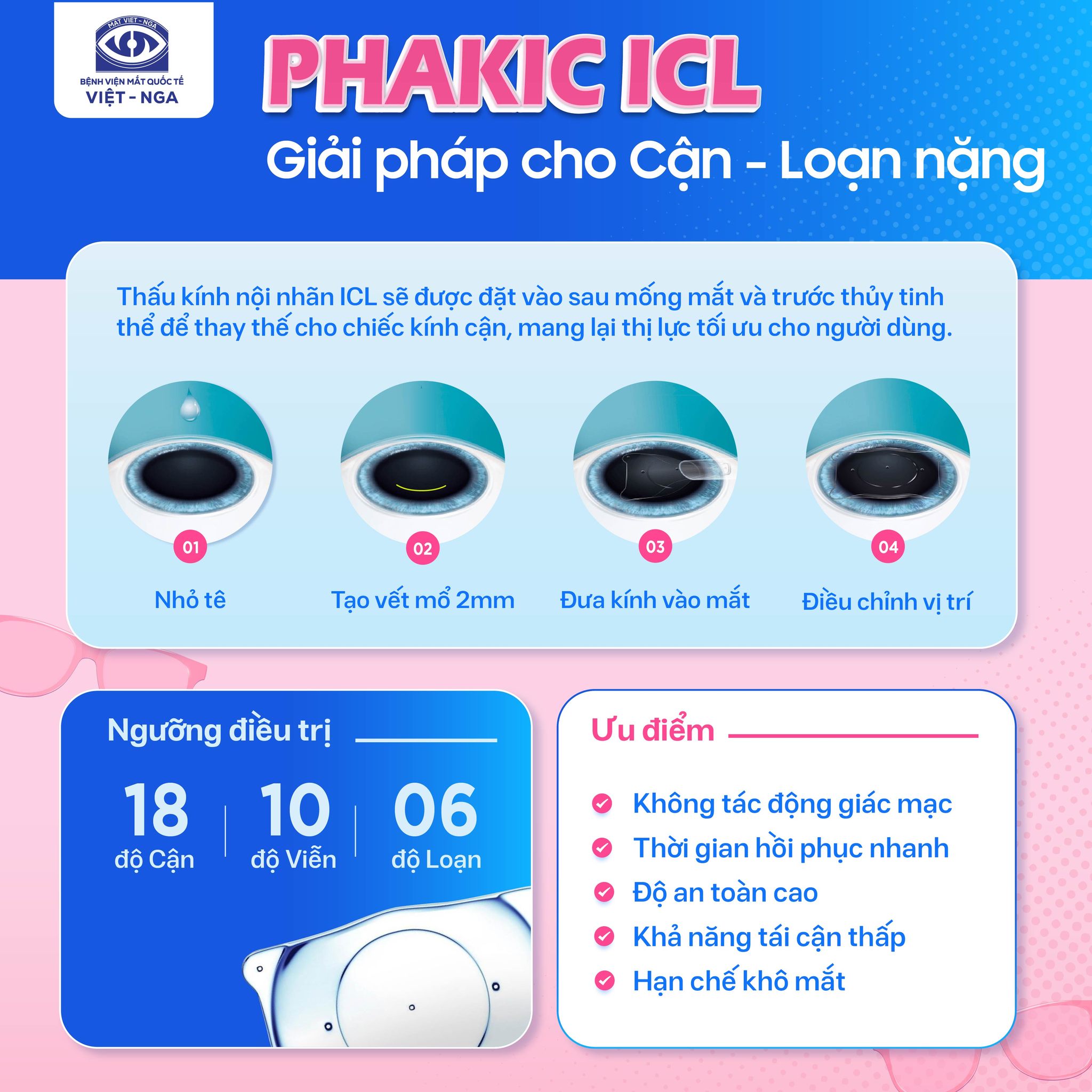 Những điều cần biết về Phakic ICL